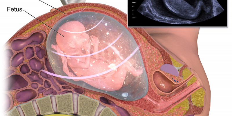 Fetal ultrasound